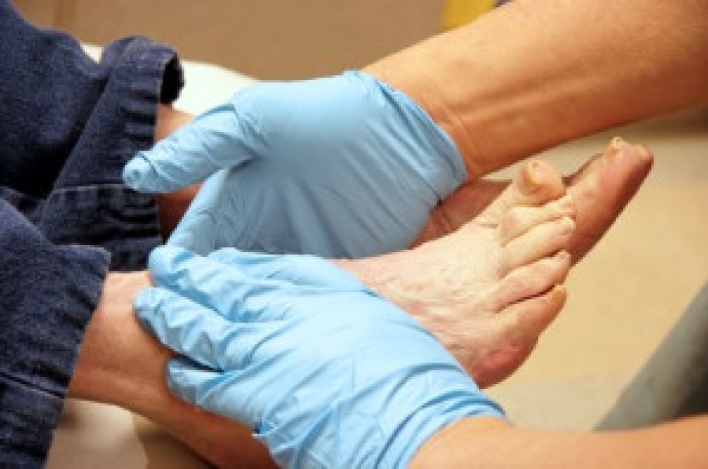 Diabetic Foot Problems That Need Podiatric Care