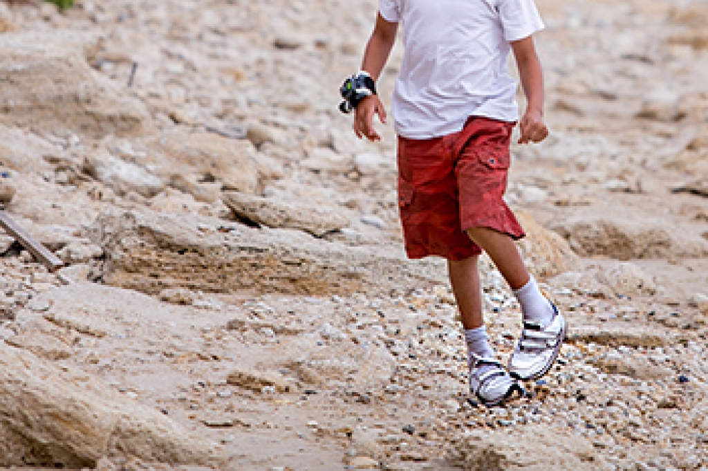 Understanding Clubfoot in Children