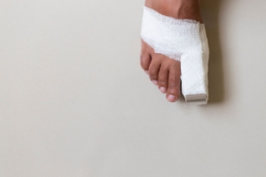 What Does a Broken Toe Look Like?