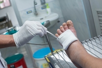 Effective Treatment for Diabetic Foot Wounds